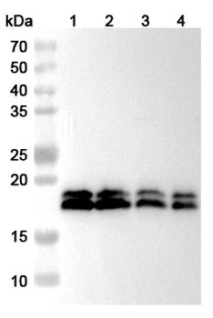 CPLX1 Rabbit Polyclonal Antibody
