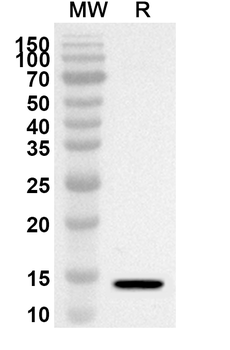 ORF7a/Protein U122 Rabbit Polyclonal Antibody