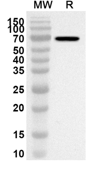NSP13 Rabbit Polyclonal Antibody