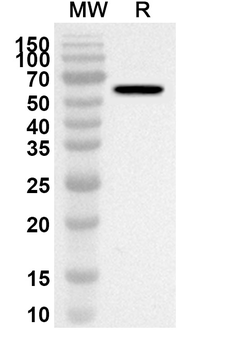 NSP12/RdRp Rabbit Polyclonal Antibody