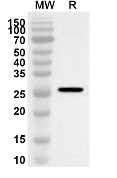 NSP3/PL-PRO Rabbit Polyclonal Antibody