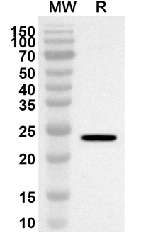 NSP1 Rabbit Polyclonal Antibody