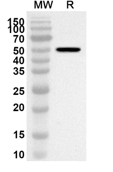 N Protein Rabbit Polyclonal Antibody