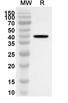 PDCoV NSP9 Rabbit Polyclonal Antibody
