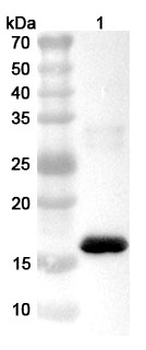 European house dust mite Der p 2/DERP2 Rabbit Polyclonal Antibody