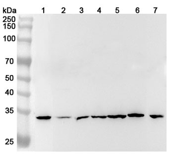 DYNLT1 Rabbit Polyclonal Antibody