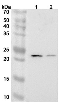 MMAB Rabbit Polyclonal Antibody