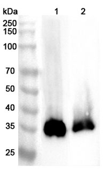 PPT1 Rabbit Polyclonal Antibody