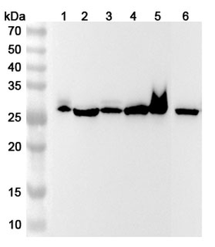 CA1/Carbonic anhydrase 1 Rabbit Polyclonal Antibody