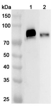 TREH Rabbit Polyclonal Antibody