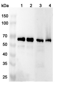 UBAP1 Rabbit Polyclonal Antibody