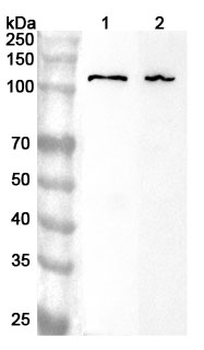 STT3A Rabbit Polyclonal Antibody