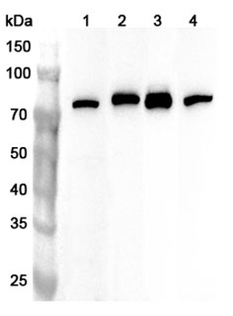 STT3A Rabbit Polyclonal Antibody