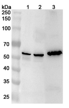 CHKA Rabbit Polyclonal Antibody