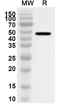 HOXB9 Rabbit Polyclonal Antibody