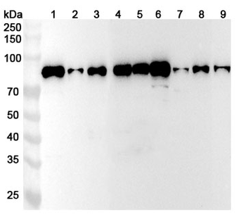CENPB Rabbit Polyclonal Antibody