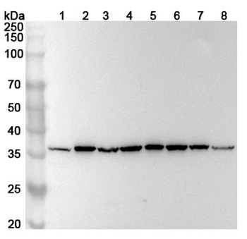 RPLP0 Rabbit Polyclonal Antibody
