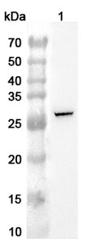 UPK1B Rabbit Polyclonal Antibody