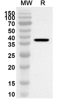 EIF3G Rabbit Polyclonal Antibody
