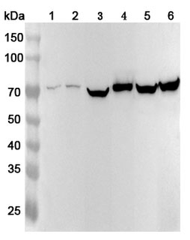 SLC25A12 Rabbit Polyclonal Antibody