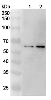 GCM2 Rabbit Polyclonal Antibody