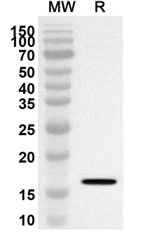 SRSF10 Rabbit Polyclonal Antibody