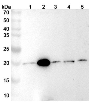GGCT Rabbit Polyclonal Antibody
