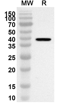 NDUFB5 Rabbit Polyclonal Antibody