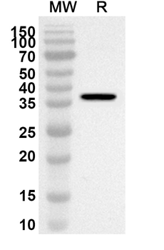 AKR7A2 Rabbit Polyclonal Antibody