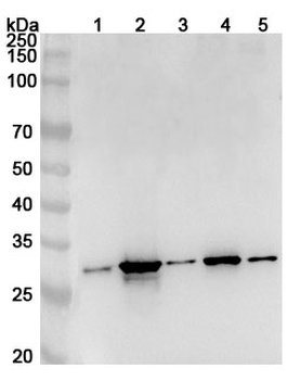 TXNDC9 Rabbit Polyclonal Antibody