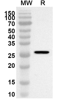IFITM5 Rabbit Polyclonal Antibody