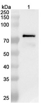 RABV NP/Nucleoprotein Rabbit Polyclonal Antibody