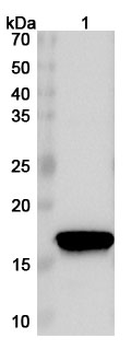 EBV/HHV4 EBNA1/BKRF1 Rabbit Polyclonal Antibody