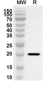 CSH1 Rabbit Polyclonal Antibody