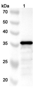 Coxsackievirus A10 VP1/Capsid protein VP1 Rabbit Polyclonal Antibody