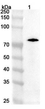 HPV16 L1/Major capsid Polyclonal Antibody L1 Rabbit Polyclonal Antibody