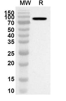 HNRNPH1 Rabbit Polyclonal Antibody