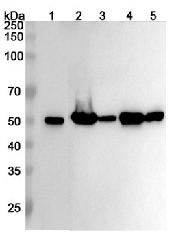 TUBB3 Rabbit Polyclonal Antibody