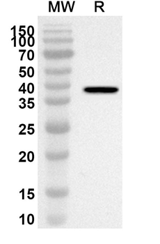 GIT2 Rabbit Polyclonal Antibody