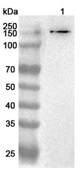 MATN2 Rabbit Polyclonal Antibody