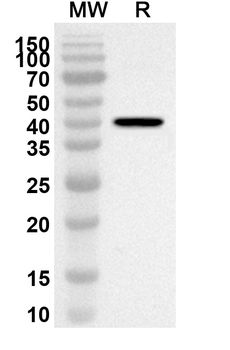SMOC2 Rabbit Polyclonal Antibody