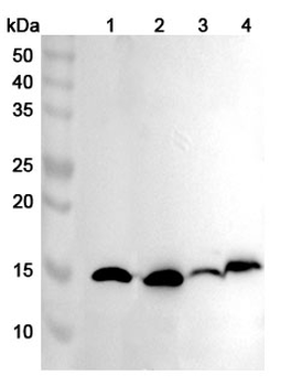 FABP5 Rabbit Polyclonal Antibody