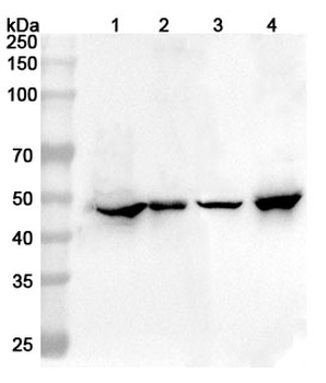 GFAP Rabbit Polyclonal Antibody