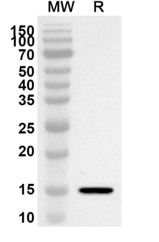 CNOT2 Rabbit Polyclonal Antibody