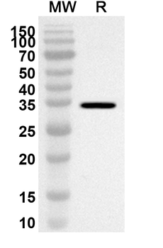 SLC17A5 Rabbit Polyclonal Antibody
