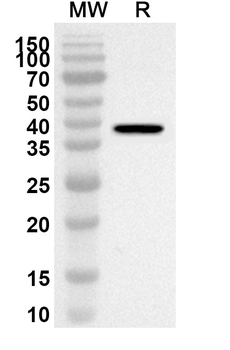 ZDHHC5 Rabbit Polyclonal Antibody