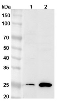 CDCA3 Rabbit Polyclonal Antibody