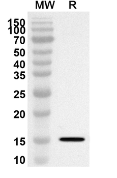 SEZ6L2 Rabbit Polyclonal Antibody