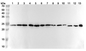 ATP5PO Rabbit Polyclonal Antibody