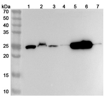 GSTT1 Rabbit Polyclonal Antibody